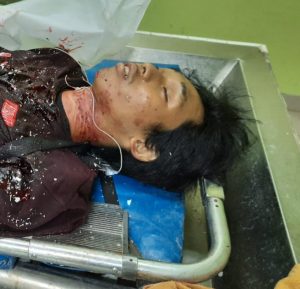 Read more about the article Polsek Bekasi Utara identitas mayat di Jalan Perjuangan Kelurahan Teluk Pucung Bekasi